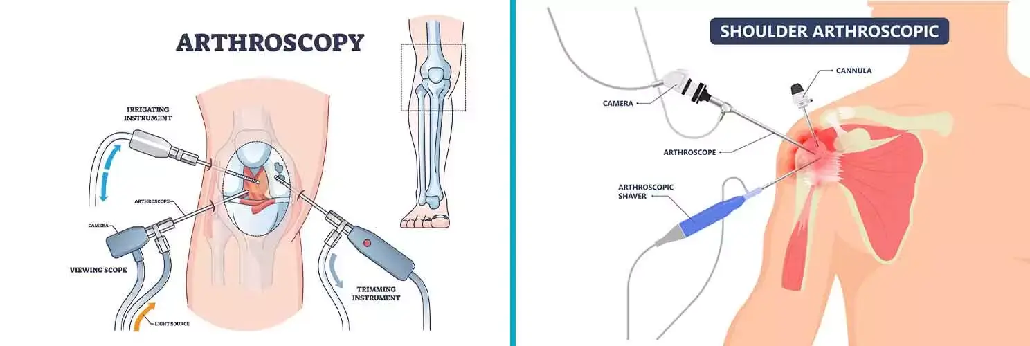 Arthroscopy doctor