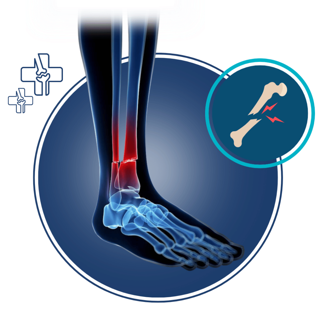 Bone Fracture Surgery Hospital in Jalandhar